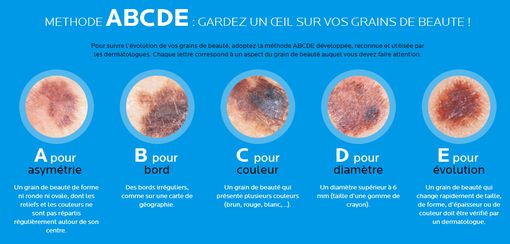 abcde-cancer-peau